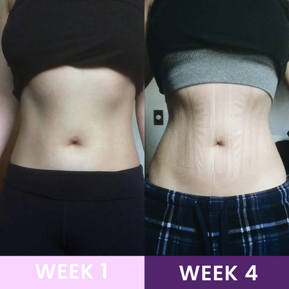 Waist Trainer | Lose Inches in Weeks